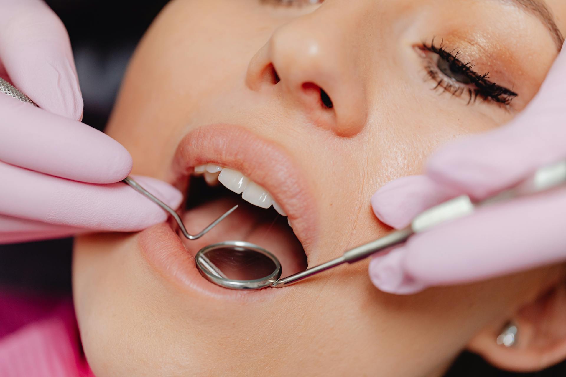Close-Up Photo of a Woman Getting a Dental Check-Up Close-Up Photo of a Woman Getting a Dental Check-Up<br />